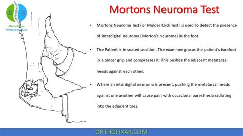 metatarsal head compression test|morton's neuroma click test.